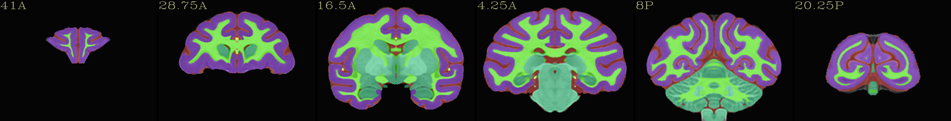 ../../_images/img_nmt2.0symss_segmentation.cor.png