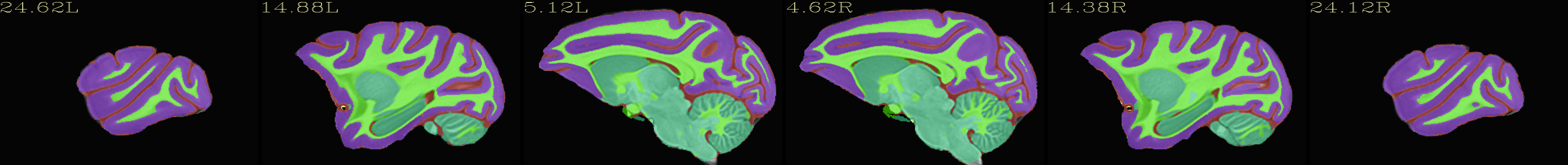 ../../_images/img_nmt2.0symss_segmentation.sag.png