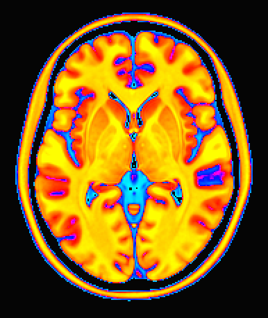 ../_images/tt_cbar_Spectrum%3Ayellow_to_cyan.axi.png